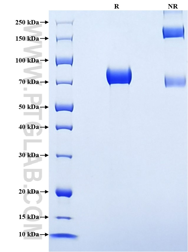 Purity of Recombinant Rat DDR1 was determined by SDS-PAGE. The protein was resolved in an SDS-PAGE in reducing (R) and non-reducing (NR) conditions and stained using Coomassie blue. Purity of Recombinant Rat DDR1 was determined by SDS-PAGE. The protein was resolved in an SDS-PAGE in reducing (R) and non-reducing (NR) conditions and stained using Coomassie blue.