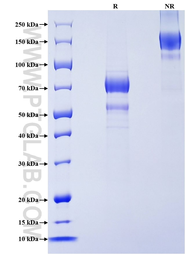 Purity of Recombinant Rat NXPH1 was determined by SDS-PAGE. The protein was resolved in an SDS-PAGE in reducing (R) and non-reducing (NR) conditions and stained using Coomassie blue. Purity of Recombinant Rat NXPH1 was determined by SDS-PAGE. The protein was resolved in an SDS-PAGE in reducing (R) and non-reducing (NR) conditions and stained using Coomassie blue.