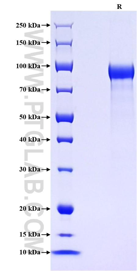 Purity of Recombinant Rat Progranulin was determined by SDS-PAGE. The protein was resolved in an SDS-PAGE in reducing (R) conditions and stained using Coomassie blue.