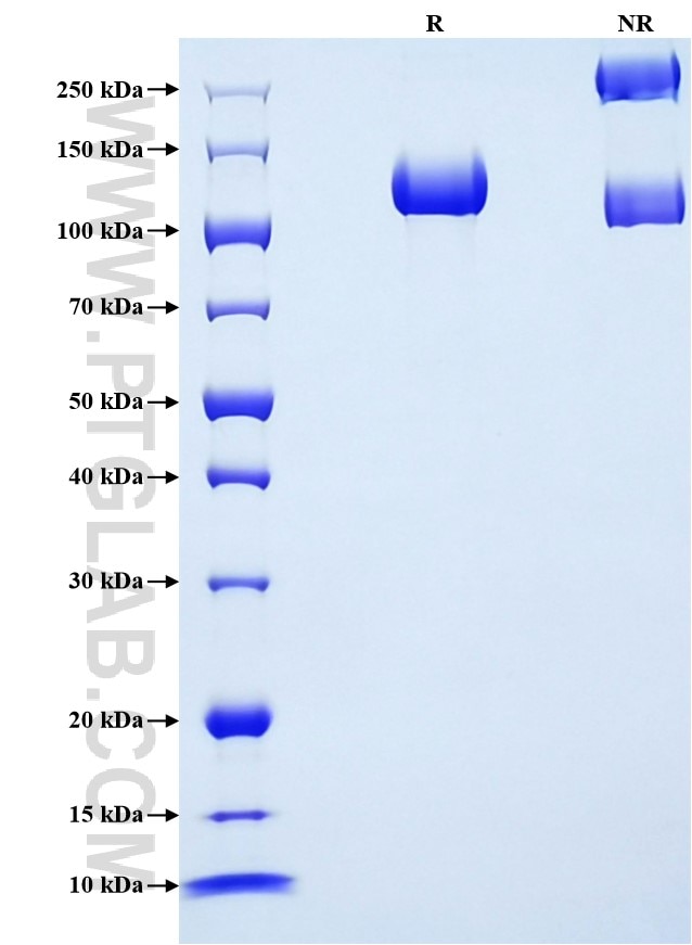 Purity of Recombinant Rat NCAM-1 was determined by SDS-PAGE. The protein was resolved in an SDS-PAGE in reducing (R) and non-reducing (NR) conditions and stained using Coomassie blue.