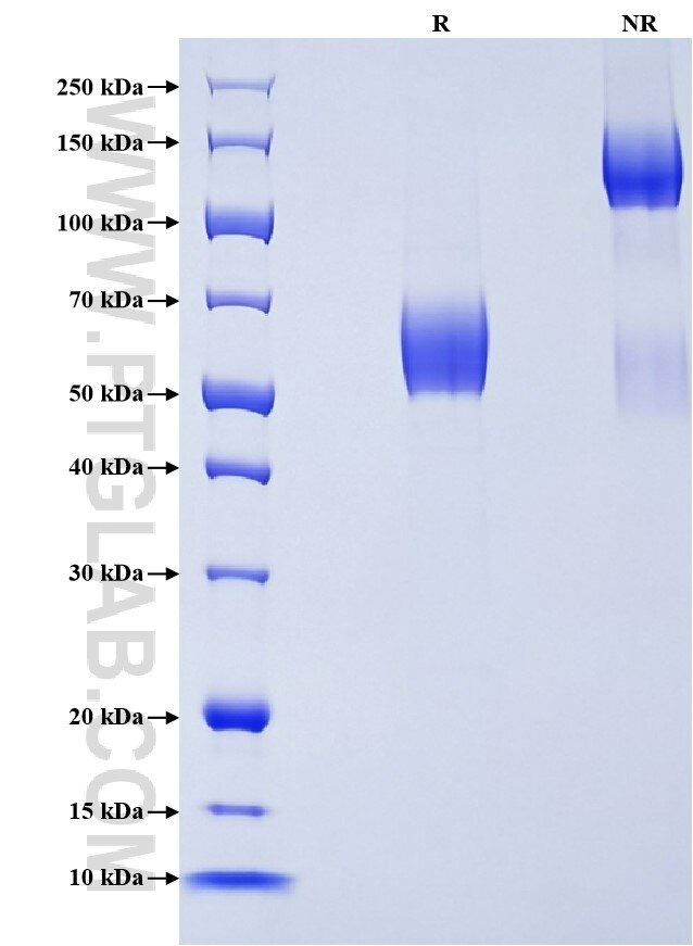 Purity of Recombinant Rat TIM-3 was determined by SDS-PAGE. The protein was resolved in an SDS-PAGE in reducing (R) and non-reducing (NR) conditions and stained using Coomassie blue.