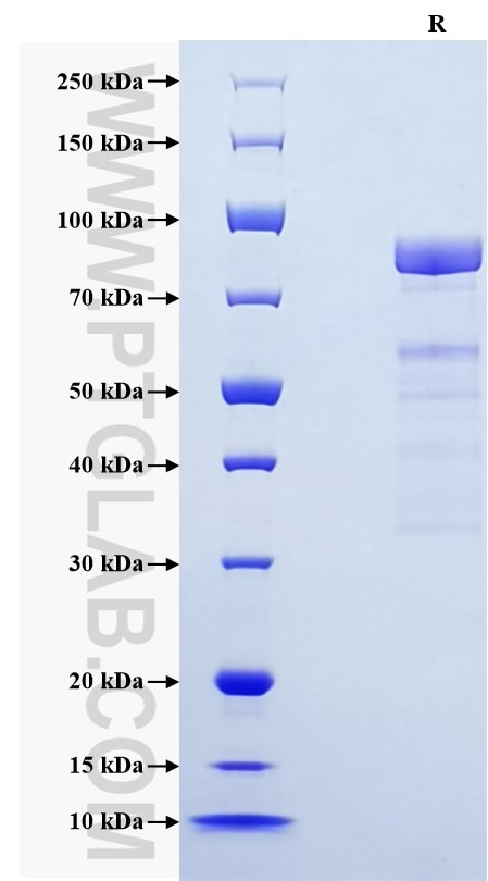 Purity of Recombinant Human IL-3RB was determined by SDS-PAGE. The protein was resolved in an SDS-PAGE in reducing (R) and non-reducing (NR) conditions and stained using Coomassie blue.