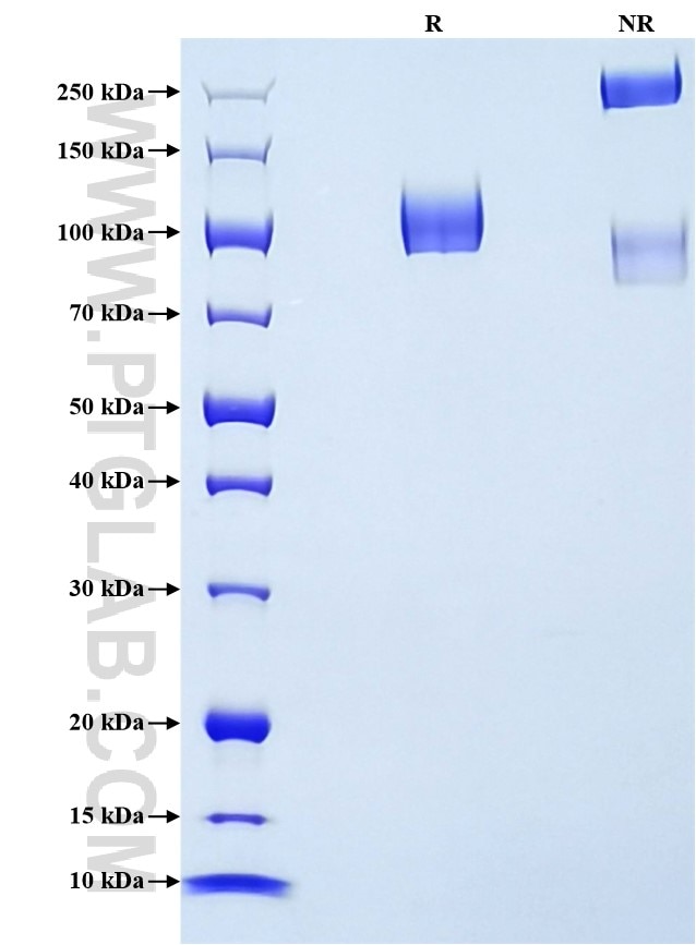 Purity of Recombinant Rat MAG was determined by SDS-PAGE. The protein was resolved in an SDS-PAGE in reducing (R) and non-reducing (NR) conditions and stained using Coomassie blue. Purity of Recombinant Rat MAG was determined by SDS-PAGE. The protein was resolved in an SDS-PAGE in reducing (R) and non-reducing (NR) conditions and stained using Coomassie blue.