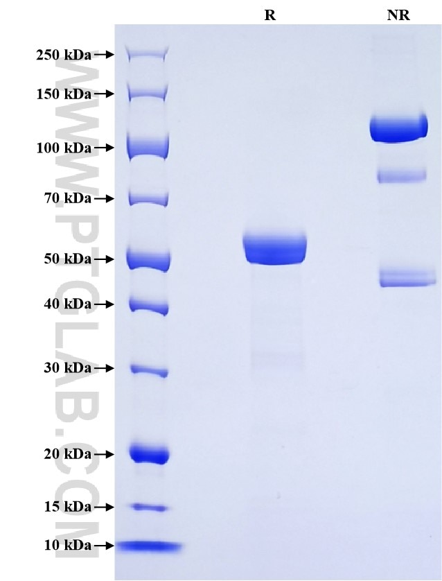 Purity of Recombinant Rat CTRB1 was determined by SDS-PAGE. The protein was resolved in an SDS-PAGE in reducing (R) and non-reducing (NR) conditions and stained using Coomassie blue. Purity of Recombinant Rat CTRB1 was determined by SDS-PAGE. The protein was resolved in an SDS-PAGE in reducing (R) and non-reducing (NR) conditions and stained using Coomassie blue.