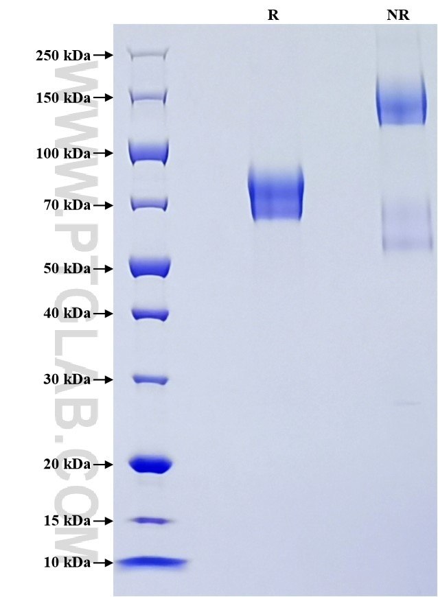 Purity of Recombinant Rat p75NTR was determined by SDS-PAGE. The protein was resolved in an SDS-PAGE in reducing (R) and non-reducing (NR) conditions and stained using Coomassie blue. Purity of Recombinant Rat p75NTR was determined by SDS-PAGE. The protein was resolved in an SDS-PAGE in reducing (R) and non-reducing (NR) conditions and stained using Coomassie blue.