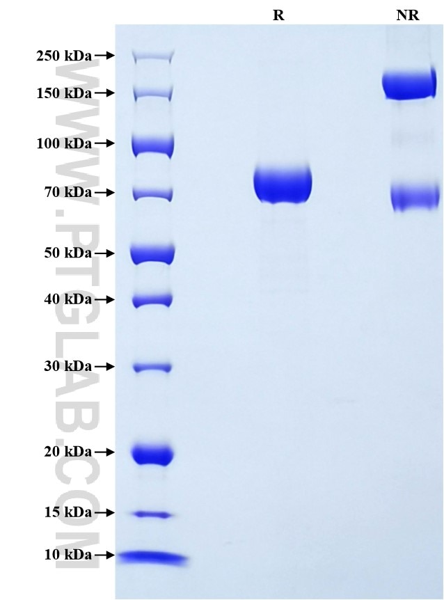 Purity of Recombinant Rat PAI-1 was determined by SDS-PAGE. The protein was resolved in an SDS-PAGE in reducing (R) and non-reducing (NR) conditions and stained using Coomassie blue.