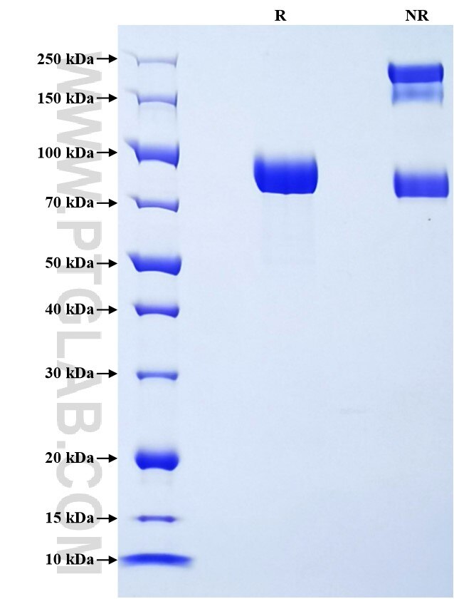 Purity of Recombinant Rat Hemopexin was determined by SDS-PAGE. The protein was resolved in an SDS-PAGE in reducing (R) and non-reducing (NR) conditions and stained using Coomassie blue. Purity of Recombinant Rat Hemopexin was determined by SDS-PAGE. The protein was resolved in an SDS-PAGE in reducing (R) and non-reducing (NR) conditions and stained using Coomassie blue.
