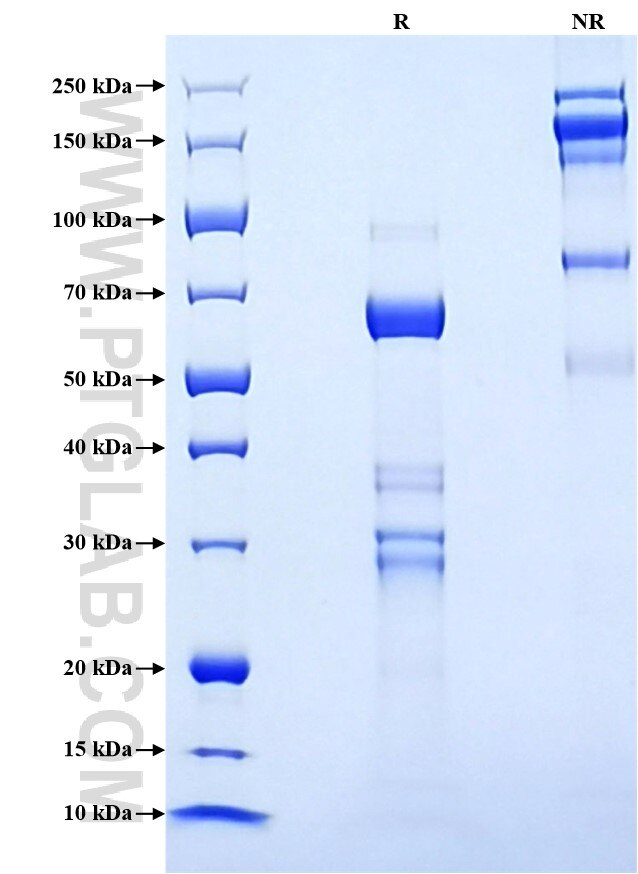 Purity of Recombinant Rat t-Plasminogen activator was determined by SDS-PAGE. The protein was resolved in an SDS-PAGE in reducing (R) and non-reducing (NR) conditions and stained using Coomassie blue.