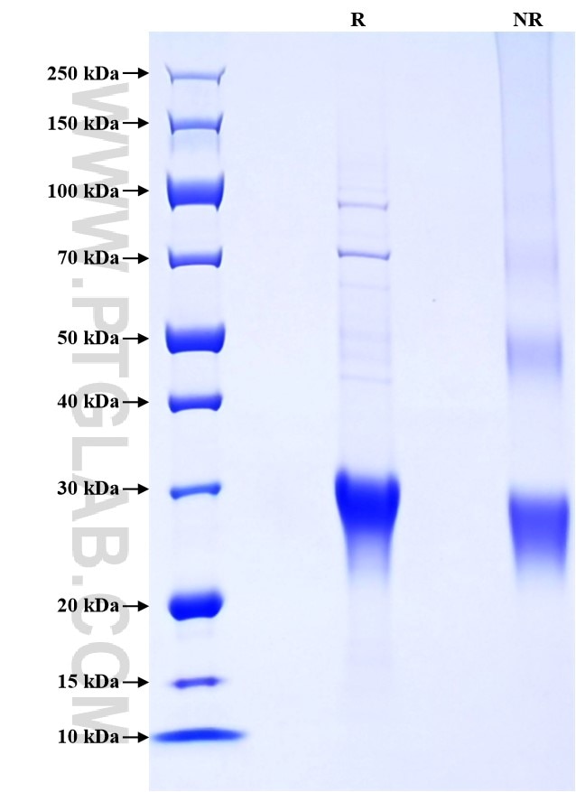 Purity of Recombinant Rabbit CD8B was determined by SDS-PAGE. The protein was resolved in an SDS-PAGE in reducing (R) and non-reducing (NR) conditions and stained using Coomassie blue.