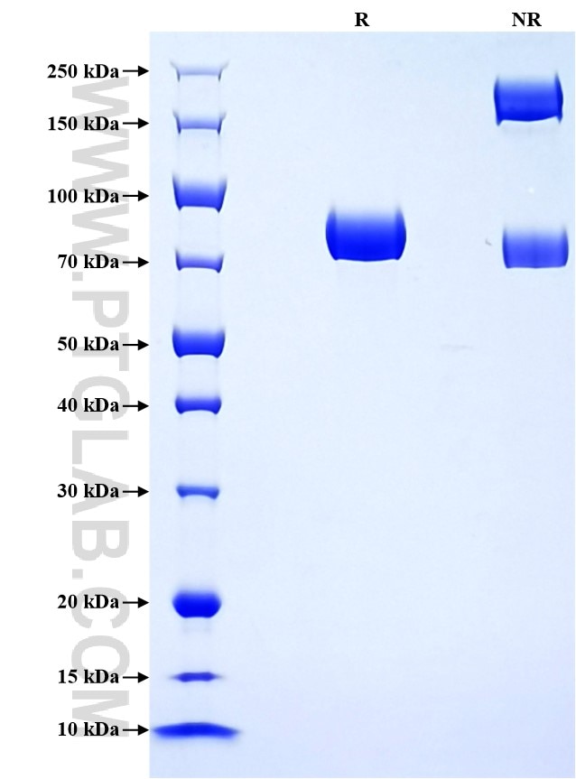 Purity of Recombinant Rat Angiotensinogen was determined by SDS-PAGE. The protein was resolved in an SDS-PAGE in reducing (R) and non-reducing (NR) conditions and stained using Coomassie blue.