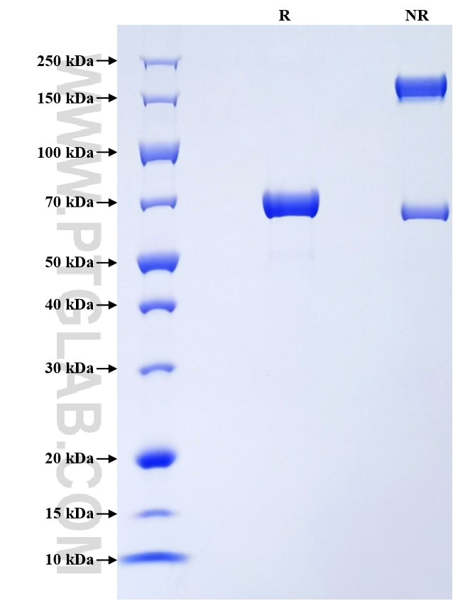 Purity of Recombinant Rat Carboxypeptidase A was determined by SDS-PAGE. The protein was resolved in an SDS-PAGE in reducing (R) and non-reducing (NR) conditions and stained using Coomassie blue. Purity of Recombinant Rat Carboxypeptidase A was determined by SDS-PAGE. The protein was resolved in an SDS-PAGE in reducing (R) and non-reducing (NR) conditions and stained using Coomassie blue.