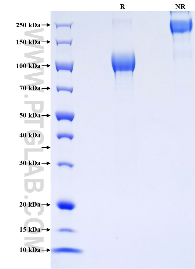 Purity of Recombinant Rat Osteoactivin was determined by SDS-PAGE. The protein was resolved in an SDS-PAGE in reducing (R) and non-reducing (NR) conditions and stained using Coomassie blue.