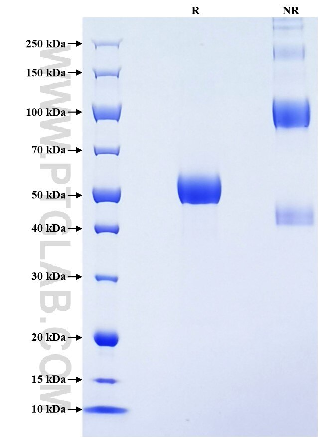 Purity of Recombinant Rat RANK was determined by SDS-PAGE. The protein was resolved in an SDS-PAGE in reducing (R) and non-reducing (NR) conditions and stained using Coomassie blue.