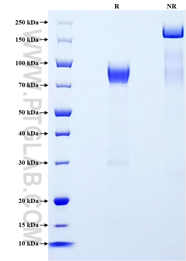 Purity of Recombinant Mouse Timd4 was determined by SDS-PAGE. The protein was resolved in an SDS-PAGE in reducing (R) and non-reducing (NR) conditions and stained using Coomassie blue.