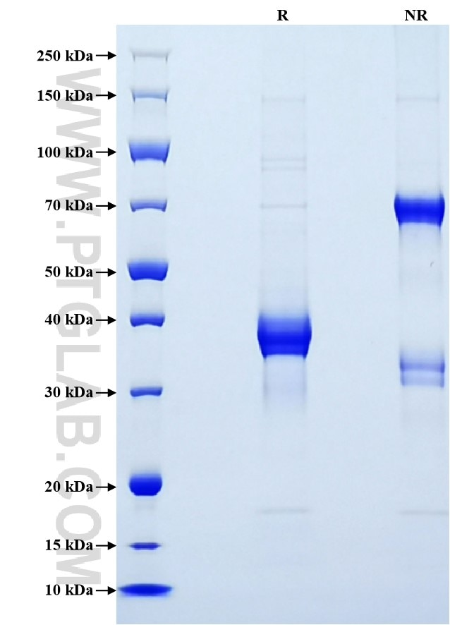 Purity of Recombinant Mouse CCL20 was determined by SDS-PAGE. The protein was resolved in an SDS-PAGE in reducing (R) and non-reducing (NR) conditions and stained using Coomassie blue.