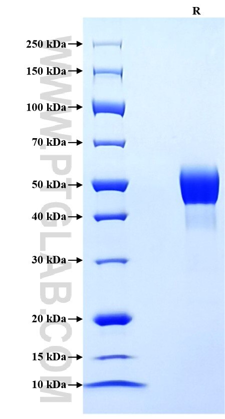 Purity of Recombinant Mouse TSLP was determined by SDS-PAGE. The protein was resolved in an SDS-PAGE in reducing (R) conditions and stained using Coomassie blue.