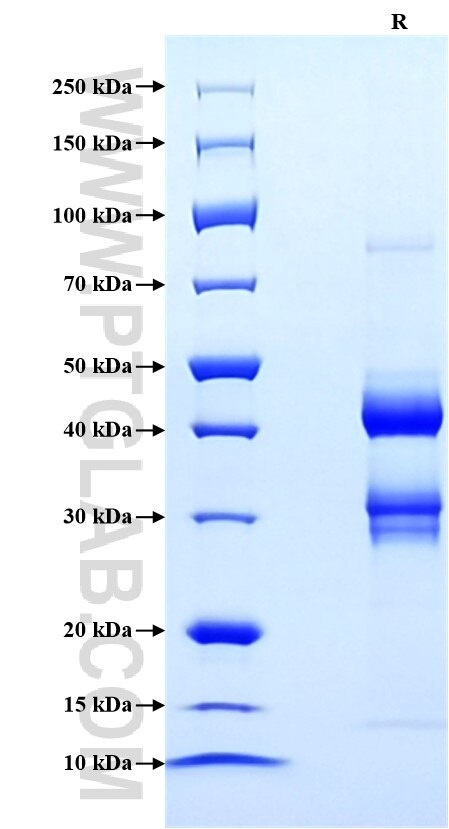 Purity of Recombinant Mouse CXCL9 was determined by SDS-PAGE. The protein was resolved in an SDS-PAGE in reducing (R) conditions and stained using Coomassie blue. Purity of Recombinant Mouse CXCL9 was determined by SDS-PAGE. The protein was resolved in an SDS-PAGE in reducing (R) conditions and stained using Coomassie blue.