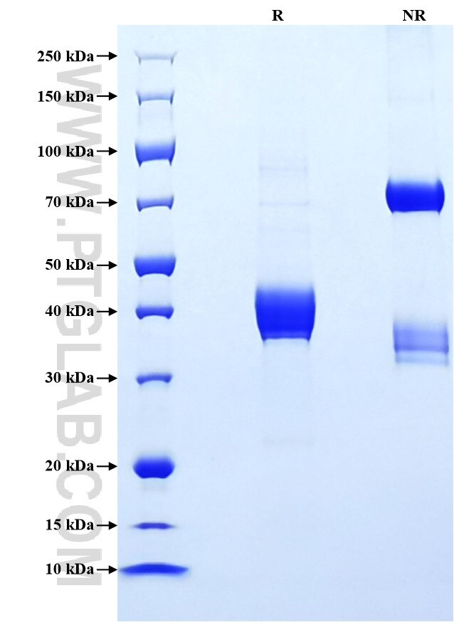 Purity of Recombinant Mouse C5 was determined by SDS-PAGE. The protein was resolved in an SDS-PAGE in reducing (R) and non-reducing (NR) conditions and stained using Coomassie blue.