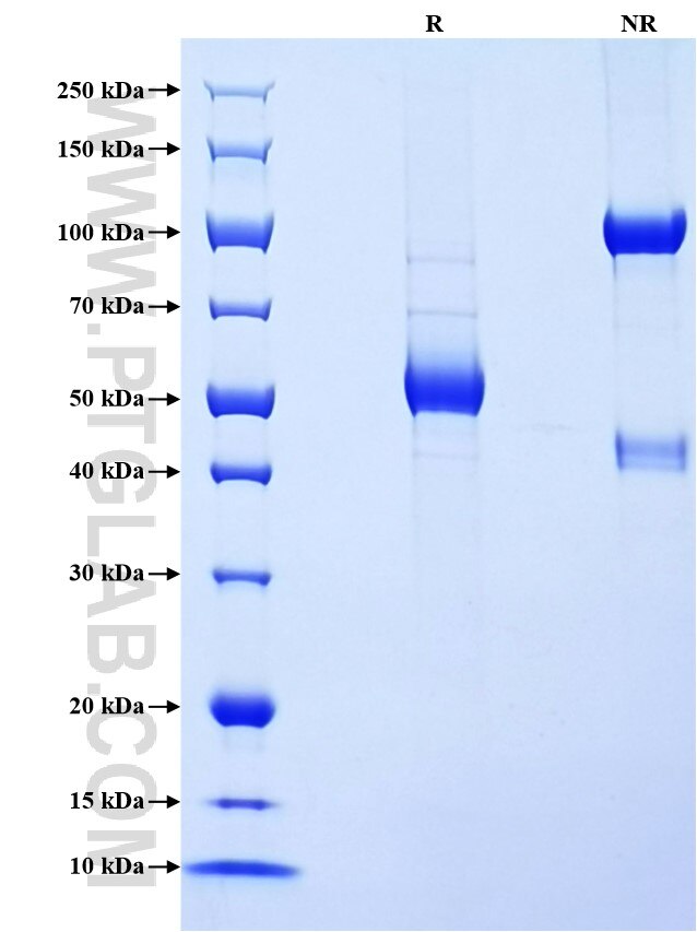 Purity of Recombinant Human TIMP4 was determined by SDS-PAGE. The protein was resolved in an SDS-PAGE in reducing (R) and non-reducing (NR) conditions and stained using Coomassie blue. Purity of Recombinant Human TIMP4 was determined by SDS-PAGE. The protein was resolved in an SDS-PAGE in reducing (R) and non-reducing (NR) conditions and stained using Coomassie blue.