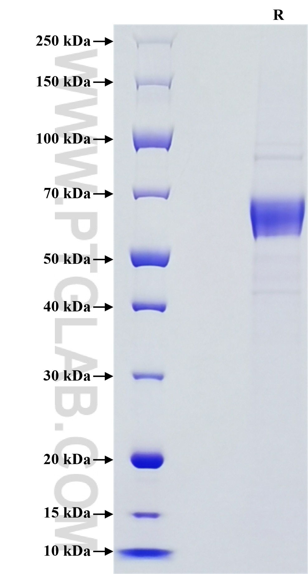Purity of Recombinant Human IL-12A was determined by SDS-PAGE. The protein was resolved in an SDS-PAGE in reducing (R) conditions and stained using Coomassie blue.
