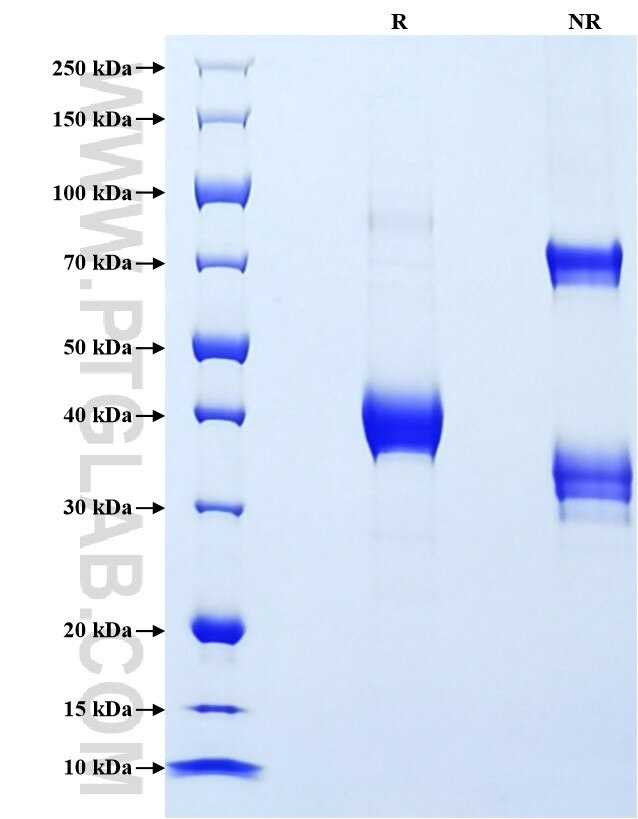 Purity of Recombinant Mouse CXCL4 was determined by SDS-PAGE. The protein was resolved in an SDS-PAGE in reducing (R) and non-reducing (NR) conditions and stained using Coomassie blue.