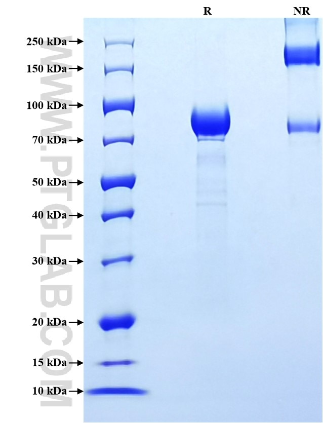 Purity of Recombinant Rat IL-6R alpha was determined by SDS-PAGE. The protein was resolved in an SDS-PAGE in reducing (R) and non-reducing (NR) conditions and stained using Coomassie blue.