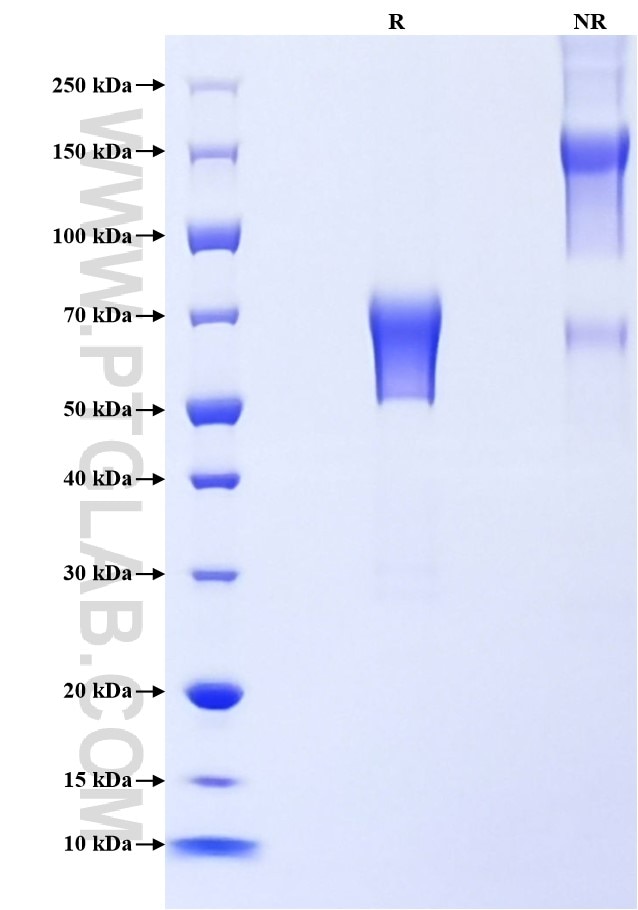 Purity of Recombinant Human TIM-3 was determined by SDS-PAGE. The protein was resolved in an SDS-PAGE in reducing (R) and non-reducing (NR) conditions and stained using Coomassie blue.