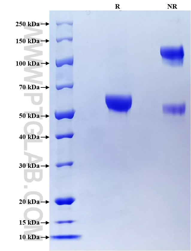 Purity of Recombinant Human Prion protein PrP was determined by SDS-PAGE. The protein was resolved in an SDS-PAGE in reducing (R) and non-reducing (NR) conditions and stained using Coomassie blue.