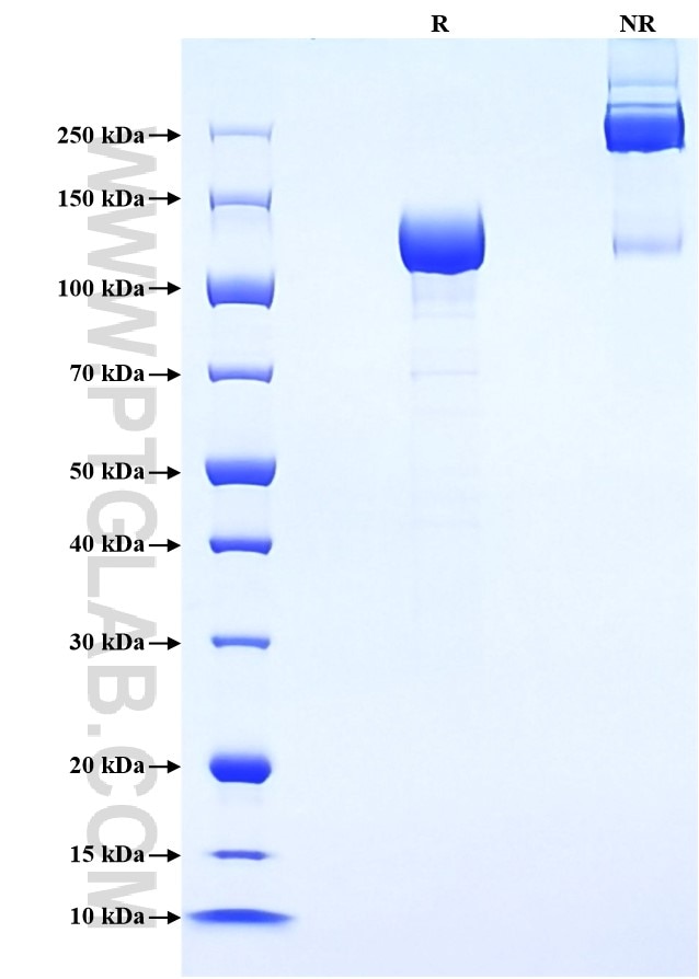 Purity of Recombinant Human Tie2 was determined by SDS-PAGE. The protein was resolved in an SDS-PAGE in reducing (R) and non-reducing (NR) conditions and stained using Coomassie blue.