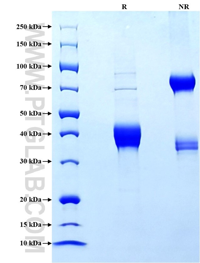 Purity of Recombinant Human CXCL6 was determined by SDS-PAGE. The protein was resolved in an SDS-PAGE in reducing (R) and non-reducing (NR) conditions and stained using Coomassie blue.