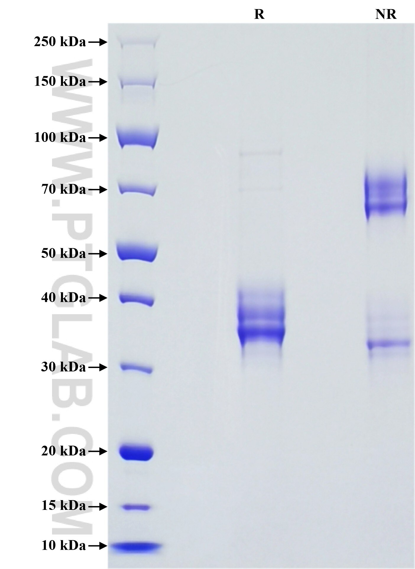 Purity of Recombinant Apolipoprotein CIII was determined by SDS-PAGE. The protein was resolved in an SDS-PAGE in reducing (R) and non-reducing (NR) conditions and stained using Coomassie blue. Purity of Recombinant Apolipoprotein CIII was determined by SDS-PAGE. The protein was resolved in an SDS-PAGE in reducing (R) and non-reducing (NR) conditions and stained using Coomassie blue.
