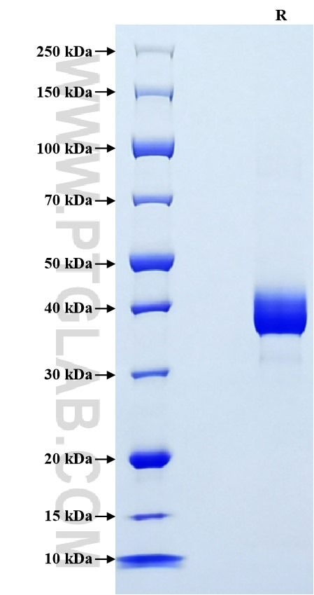 Purity of Recombinant Mouse Resistin was determined by SDS-PAGE. The protein was resolved in an SDS-PAGE in reducing (R) conditions and stained using Coomassie blue.