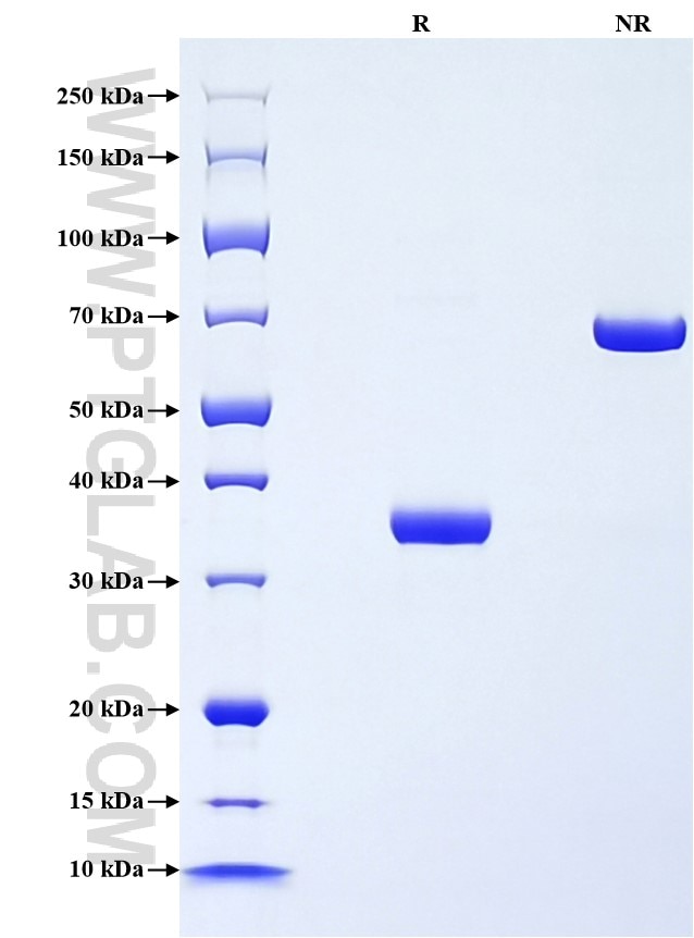 Purity of Recombinant Rat CXCL7 was determined by SDS-PAGE. The protein was resolved in an SDS-PAGE in reducing (R) and non-reducing (NR) conditions and stained using Coomassie blue. Purity of Recombinant Rat CXCL7 was determined by SDS-PAGE. The protein was resolved in an SDS-PAGE in reducing (R) and non-reducing (NR) conditions and stained using Coomassie blue.