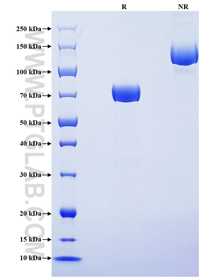 Purity of Recombinant Rat Lumican was determined by SDS-PAGE. The protein was resolved in an SDS-PAGE in reducing (R) and non-reducing (NR) conditions and stained using Coomassie blue.