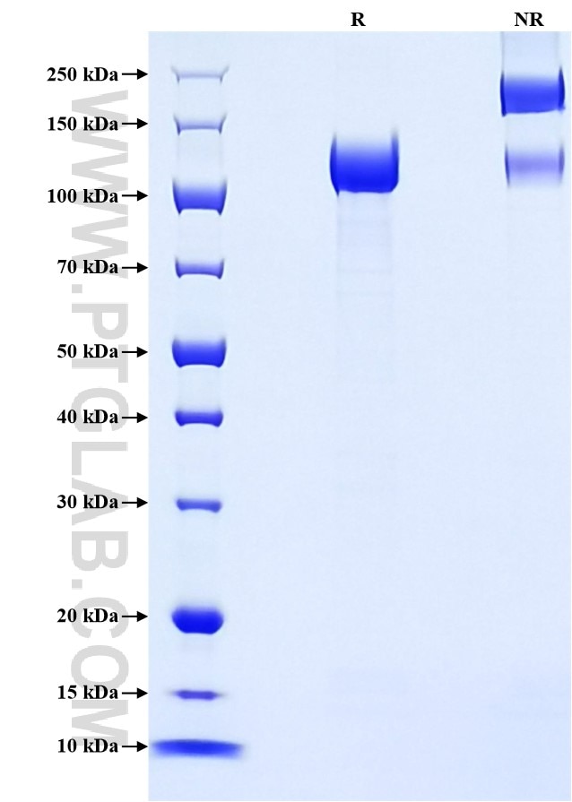 Purity of Recombinant Rat Agrin was determined by SDS-PAGE. The protein was resolved in an SDS-PAGE in reducing (R) and non-reducing (NR) conditions and stained using Coomassie blue. Purity of Recombinant Rat Agrin was determined by SDS-PAGE. The protein was resolved in an SDS-PAGE in reducing (R) and non-reducing (NR) conditions and stained using Coomassie blue.