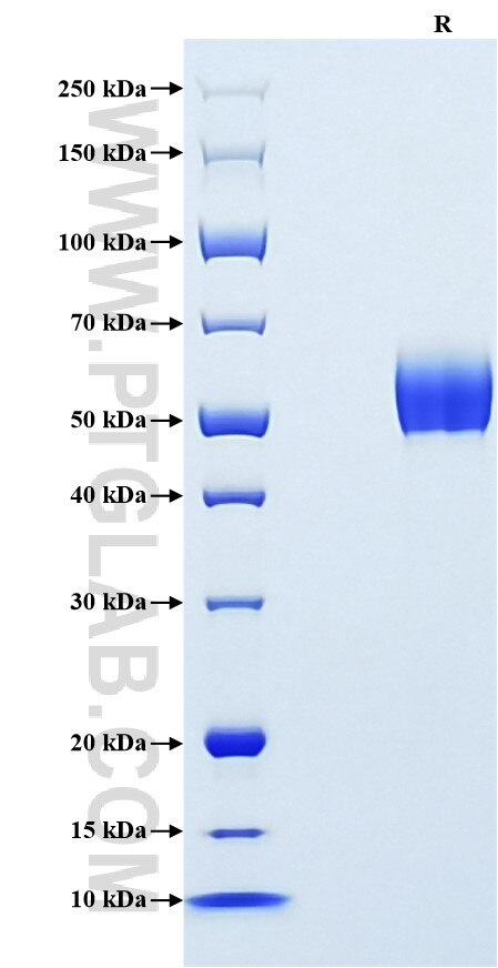 Purity of Recombinant Rat M-CSF was determined by SDS-PAGE. The protein was resolved in an SDS-PAGE in reducing (R) conditions and stained using Coomassie blue. Purity of Recombinant Rat M-CSF was determined by SDS-PAGE. The protein was resolved in an SDS-PAGE in reducing (R) conditions and stained using Coomassie blue.