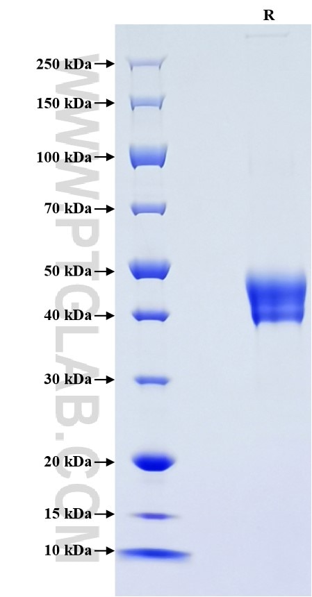 Purity of Recombinant Rat ACVR1 was determined by SDS-PAGE. The protein was resolved in an SDS-PAGE in reducing (R) conditions and stained using Coomassie blue. Purity of Recombinant Rat ACVR1 was determined by SDS-PAGE. The protein was resolved in an SDS-PAGE in reducing (R) conditions and stained using Coomassie blue.