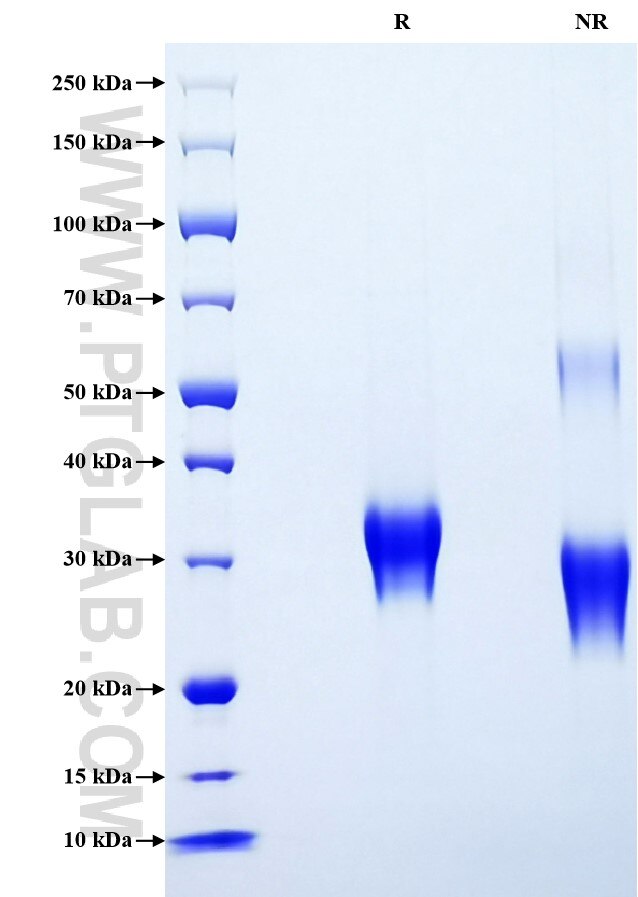 Purity of Recombinant Human IGFBP-6 was determined by SDS-PAGE. The protein was resolved in an SDS-PAGE in reducing (R) and non-reducing (NR) conditions and stained using Coomassie blue. Purity of Recombinant Human IGFBP-6 was determined by SDS-PAGE. The protein was resolved in an SDS-PAGE in reducing (R) and non-reducing (NR) conditions and stained using Coomassie blue.