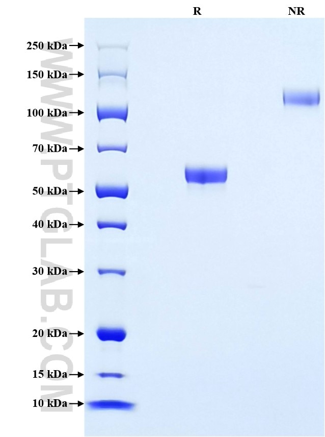 Purity of Recombinant Human PrP was determined by SDS-PAGE. The protein was resolved in an SDS-PAGE in reducing (R) and non-reducing (NR) conditions and stained using Coomassie blue.