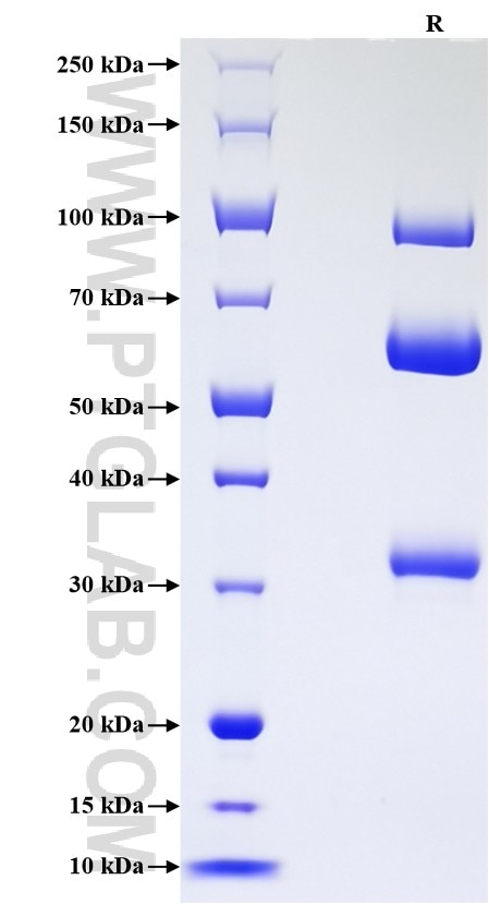 Purity of Recombinant Human RON was determined by SDS-PAGE. The protein was resolved in an SDS-PAGE in reducing (R) conditions and stained using Coomassie blue. Purity of Recombinant Human RON was determined by SDS-PAGE. The protein was resolved in an SDS-PAGE in reducing (R) conditions and stained using Coomassie blue.