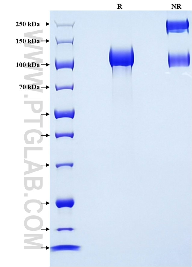 Purity of Recombinant Mouse EGFR was determined by SDS-PAGE. The protein was resolved in an SDS-PAGE in reducing (R) and non-reducing (NR) conditions and stained using Coomassie blue. Purity of Recombinant Mouse EGFR was determined by SDS-PAGE. The protein was resolved in an SDS-PAGE in reducing (R) and non-reducing (NR) conditions and stained using Coomassie blue.