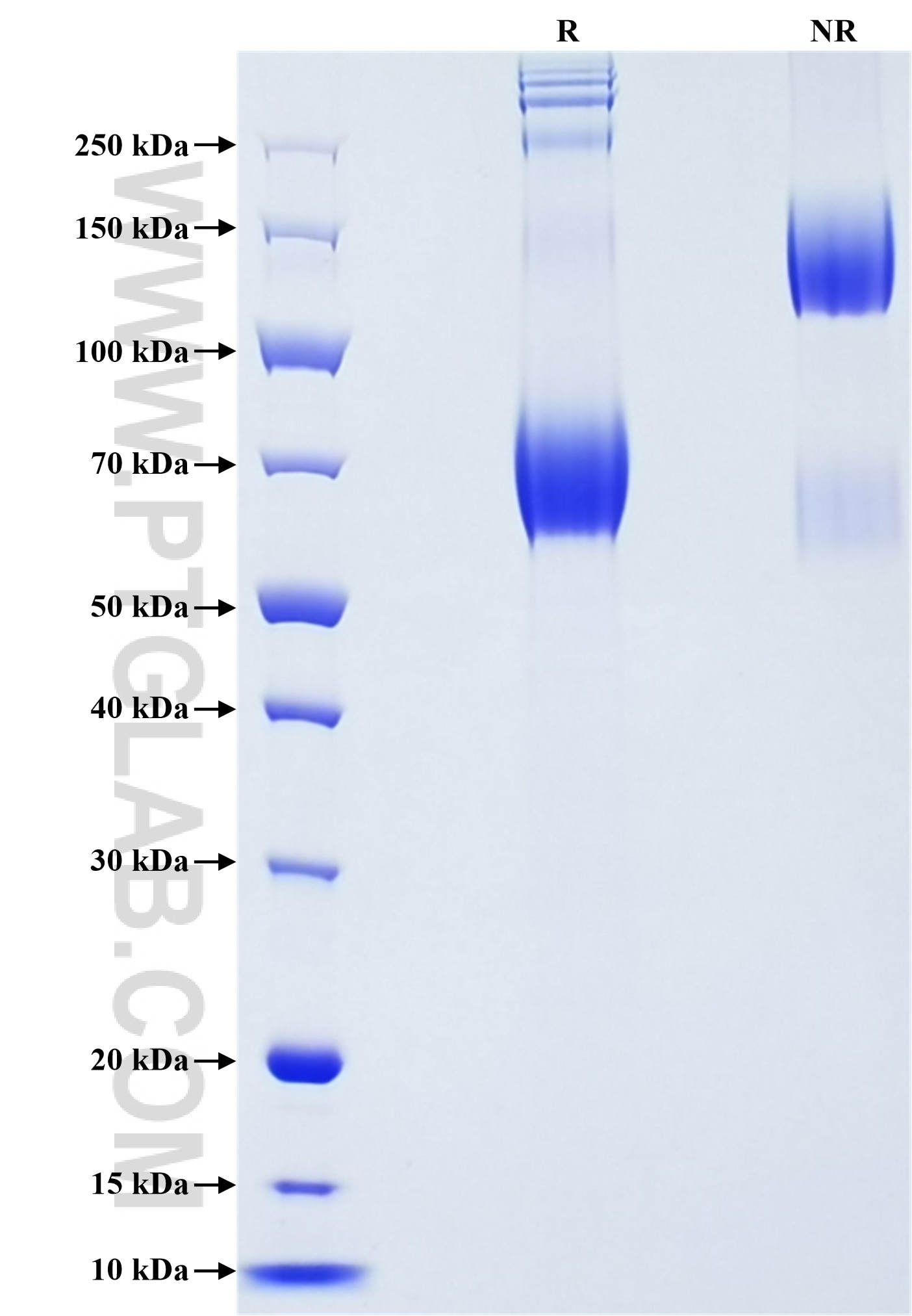 Purity of Recombinant Human CD80 was determined by SDS-PAGE. The protein was resolved in an SDS-PAGE in reducing (R) and non-reducing (NR) conditions and stained using Coomassie blue.