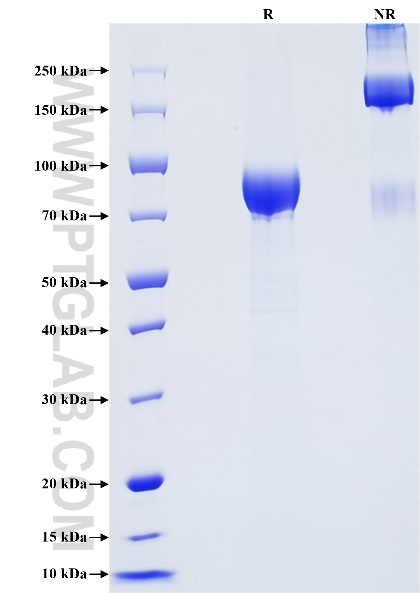 Purity of Recombinant Human FGFR4 was determined by SDS-PAGE. The protein was resolved in an SDS-PAGE in reducing (R) and non-reducing (NR) conditions and stained using Coomassie blue. Purity of Recombinant Human FGFR4 was determined by SDS-PAGE. The protein was resolved in an SDS-PAGE in reducing (R) and non-reducing (NR) conditions and stained using Coomassie blue.