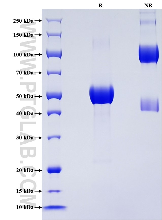 Purity of Recombinant Human RANK was determined by SDS-PAGE. The protein was resolved in an SDS-PAGE in reducing (R) and non-reducing (NR) conditions and stained using Coomassie blue. Purity of Recombinant Human RANK was determined by SDS-PAGE. The protein was resolved in an SDS-PAGE in reducing (R) and non-reducing (NR) conditions and stained using Coomassie blue.