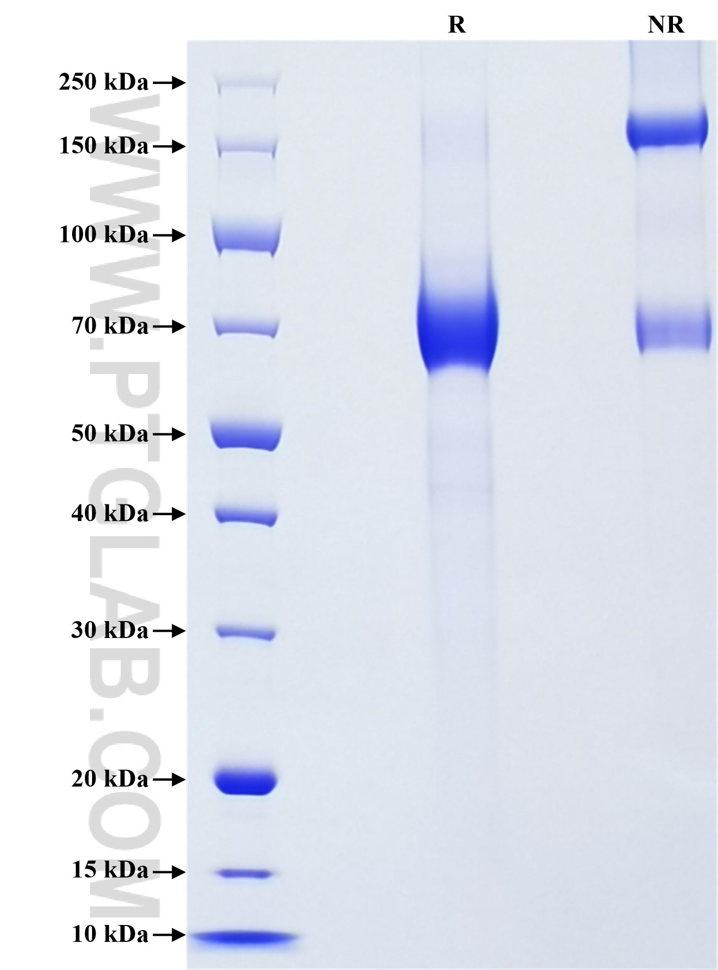 Purity of Recombinant Human KIR3DL1 was determined by SDS-PAGE. The protein was resolved in an SDS-PAGE in reducing (R) and non-reducing (NR) conditions and stained using Coomassie blue. Purity of Recombinant Human KIR3DL1 was determined by SDS-PAGE. The protein was resolved in an SDS-PAGE in reducing (R) and non-reducing (NR) conditions and stained using Coomassie blue.