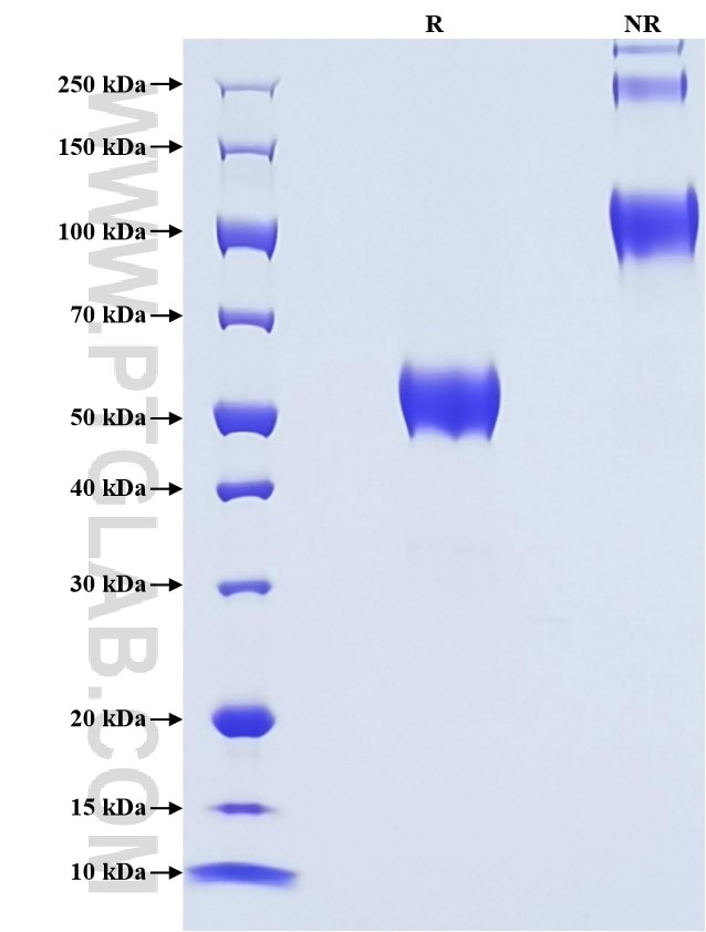 Purity of Recombinant Mouse HE4 was determined by SDS-PAGE. The protein was resolved in an SDS-PAGE in reducing (R) and non-reducing (NR) conditions and stained using Coomassie blue.