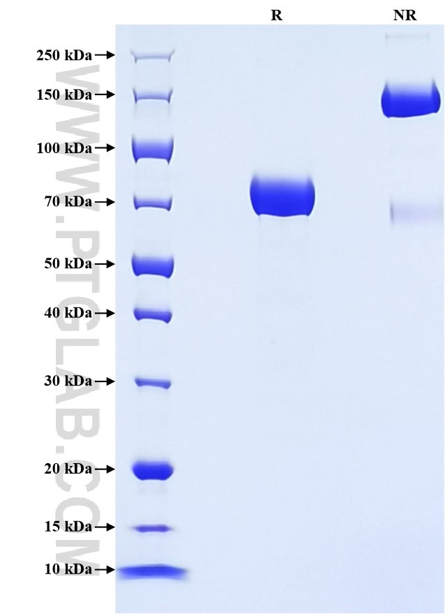 Purity of Recombinant Human APOH was determined by SDS-PAGE. The protein was resolved in an SDS-PAGE in reducing (R) and non-reducing (NR) conditions and stained using Coomassie blue. Purity of Recombinant Human APOH was determined by SDS-PAGE. The protein was resolved in an SDS-PAGE in reducing (R) and non-reducing (NR) conditions and stained using Coomassie blue.