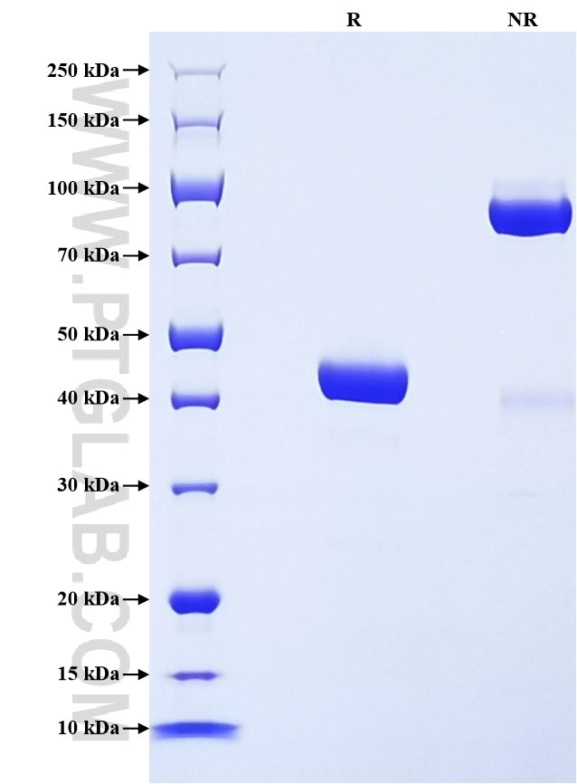 Purity of Recombinant Human Cystatin S was determined by SDS-PAGE. The protein was resolved in an SDS-PAGE in reducing (R) and non-reducing (NR) conditions and stained using Coomassie blue.