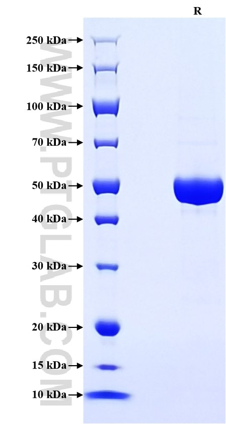Purity of Recombinant Human PGLYRP1 was determined by SDS-PAGE. The protein was resolved in an SDS-PAGE in reducing (R) conditions and stained using Coomassie blue.