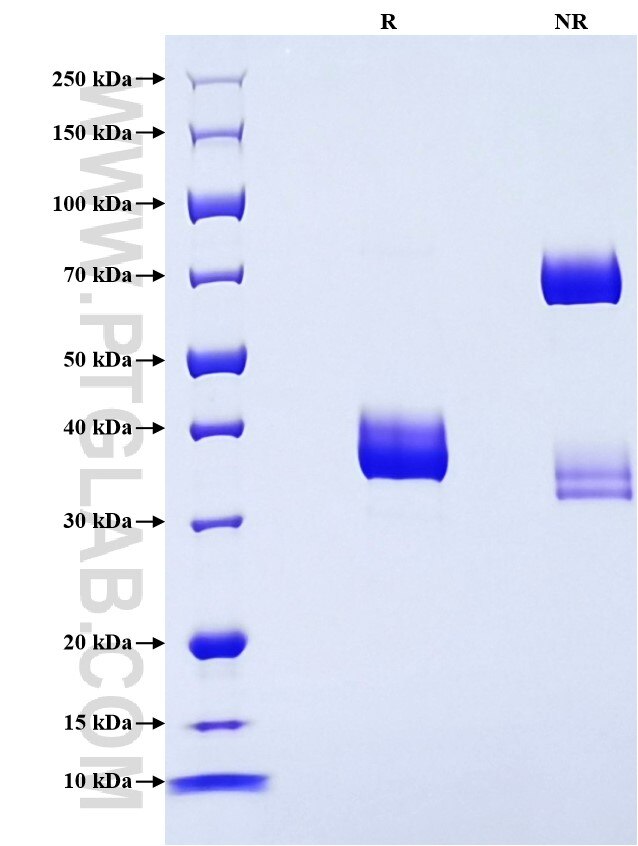 Purity of Recombinant Human CXCL7 was determined by SDS-PAGE. The protein was resolved in an SDS-PAGE in reducing (R) and non-reducing (NR) conditions and stained using Coomassie blue. Purity of Recombinant Human CXCL7 was determined by SDS-PAGE. The protein was resolved in an SDS-PAGE in reducing (R) and non-reducing (NR) conditions and stained using Coomassie blue.